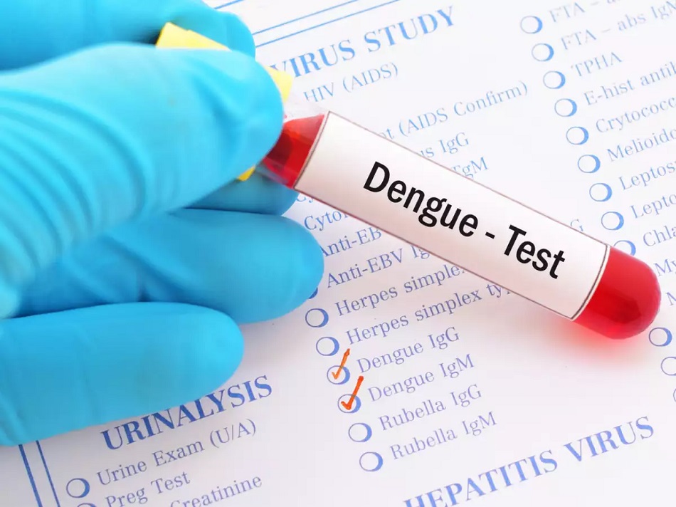 Diagnosis of dengue