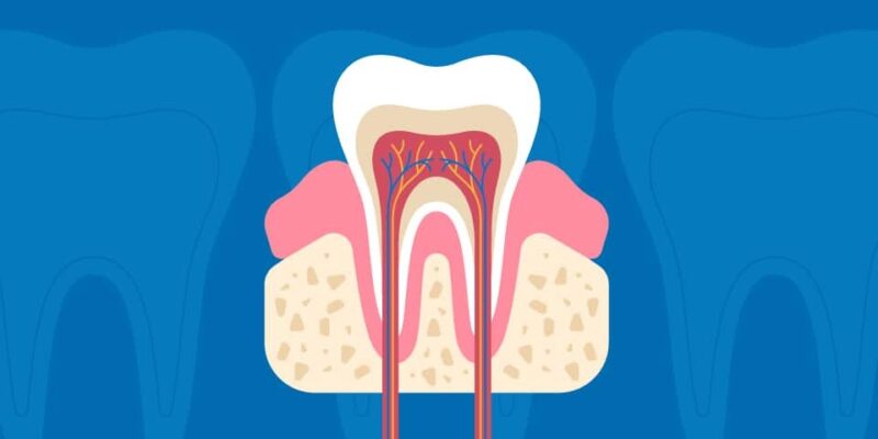 The Importance Of Root Planing In The Prevention Of Gum Disease ...