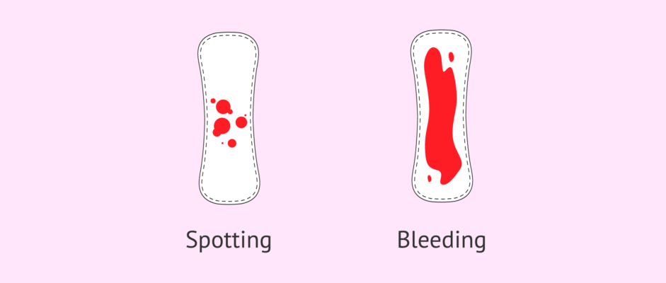 How much bleeding is normal during early pregnancy? - Fitness Soultions